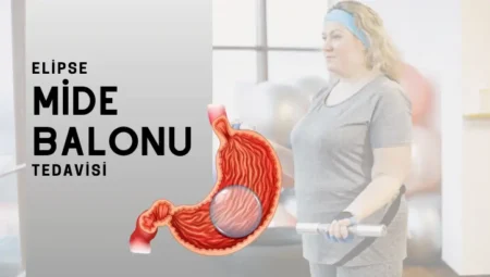 Yutulan Mide Balonu Fiyat 2025: Ne Kadar, Neye Göre Değişiyor?